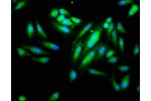 Immunofluorescence staining of Hela cells with ABIN7156207 at 1:266, counter-stained with DAPI. (IDO1 抗体  (AA 1-403))