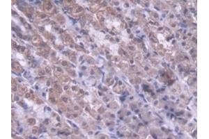 Detection of MTX1 in Rat Stomach Tissue using Polyclonal Antibody to Metaxin 1 (MTX1) (Metaxin 1 抗体  (AA 163-324))
