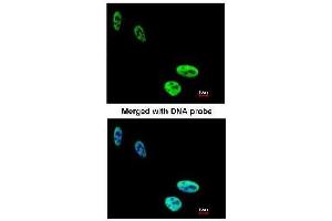 AP19041PU-N hnRNP-C1/C2 antibody staining of Paraformaldehyde-fixed HeLa by Immunofluorescence at 1/200 dilution. (HNRNPC 抗体  (N-Term))