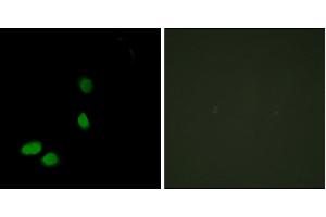 Immunofluorescence analysis of HeLa cells, using HMG17 antibody. (HMGN2 抗体)