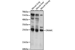 DRAM 抗体  (AA 100-200)