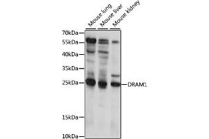 Western blot analysis of extracts of various cell lines, using DR antibody (ABIN7266817) at 1:1000 dilution. (DRAM 抗体  (AA 100-200))