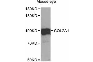 Western blot analysis of extracts of mouse eye, using COL2A1 antibody (ABIN1871948) at 1:1000 dilution. (COL2A1 抗体)