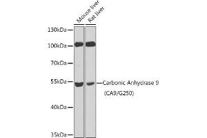 Western blot analysis of extracts of various cell lines, using Carbonic Anhydrase 9 (C/G250) antibody (ABIN6131267, ABIN6137799, ABIN6137801 and ABIN6218748) at 1:100 dilution. (CA9 抗体  (AA 52-151))
