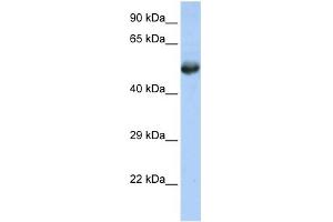 WB Suggested Anti-FLI1 Antibody Titration:  0. (FLI1 抗体  (Middle Region))