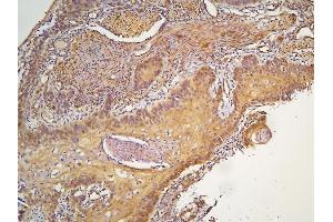 IHC analysis of HOOK3 using anti-HOOK3 antibody (ABIN6719547).