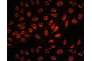 Immunofluorescence analysis of U-2 OS cells using RBM25 Polyclonal Antibody at dilution of 1:100. (RBM25 抗体)