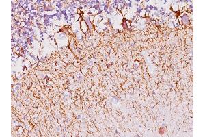 Formalin-fixed, paraffin-embedded human Cerebellum stained with Neurofilament Mouse Monoclonal Antibody (NF421). (NEFH 抗体)