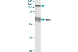 Immunoprecipitation of CC2D1A transfected lysate using anti-CC2D1A MaxPab rabbit polyclonal antibody and Protein A Magnetic Bead , and immunoblotted with CC2D1A MaxPab rabbit polyclonal antibody (D01) . (CC2D1A 抗体  (AA 1-951))