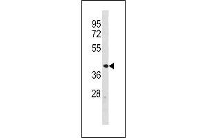 ZFP92 Antibody (N-term) (ABIN1882009 and ABIN2843295) western blot analysis in human Uterus tissue lysates (35 μg/lane). (ZNF92 抗体  (N-Term))