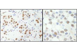 anti-Nuclear Transcription Factor Y, alpha (NFYA) (AA 333-347) antibody