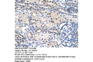 Rabbit Anti-PAIP1 Antibody  Paraffin Embedded Tissue: Human Kidney Cellular Data: Epithelial cells of renal tubule Antibody Concentration: 4. (PAIP1 抗体  (C-Term))