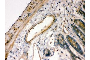 Anti- IKB alpha Picoband antibody, IHC(P) IHC(P): Rat Intestine Tissue (NFKBIA 抗体  (AA 3-112))