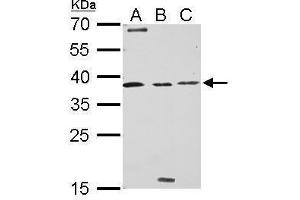 WB Image Livin antibody detects BIRC7 protein by Western blot analysis. (BIRC7 抗体)