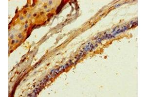 Immunohistochemistry (IHC) image for anti-Collagen, Type II, alpha 1 (COL2A1) (AA 1143-1297) antibody (ABIN7148239)