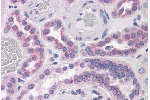 Human Kidney: Formalin-Fixed, Paraffin-Embedded (FFPE) (GPR3 抗体  (AA 1-331))