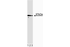 Western blot analysis of ICBP90 on HeLa lysate. (UHRF1 抗体  (AA 199-298))
