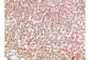 Immunohistochemical analysis of paraffin-embedded human-liver, antibody was diluted at 1:200 (EPG5 抗体  (AA 141-190))
