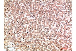 Immunohistochemical analysis of paraffin-embedded human-liver, antibody was diluted at 1:200 (EPG5 抗体  (AA 141-190))