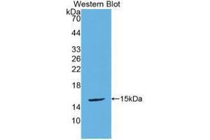 Western blot analysis of the recombinant protein. (Urocortin 2 抗体  (AA 31-112))