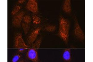 Immunofluorescence analysis of U-2 OS cells using PLK1 Polyclonal Antibody at dilution of 1:100 (40x lens). (PLK1 抗体)