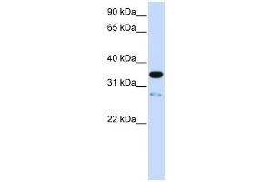TMEM38A antibody used at 1 ug/ml to detect target protein. (TMEM38A 抗体  (N-Term))