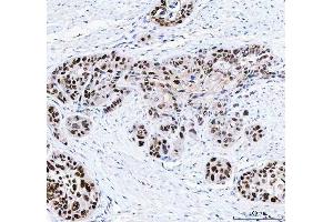 IHC analysis of FEN1 using anti-FEN1 antibody (ABIN7601617). (FEN1 抗体  (AA 4-300))