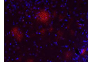 Indirect immunostaining of a PFA fixed formic acid treated brain section from a triple transgenic Alzheimer´s disease mouse (dilution 1 : 500; red). (Abeta 1-42 抗体)