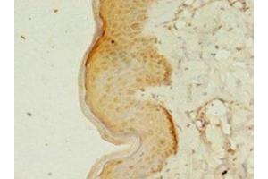 Immunohistochemistry of paraffin-embedded human skin tissue using ABIN7167192 at dilution of 1:100 (RERG 抗体  (AA 1-199))