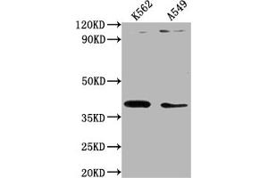 Western Blot Positive WB detected in: K562 whole cell lysate, A549 whole cell lysate All lanes: TMOD1 antibody at 1:1000 Secondary Goat polyclonal to rabbit IgG at 1/50000 dilution Predicted band size: 41, 27 kDa Observed band size: 41 kDa (Tropomodulin 1 抗体  (AA 105-359))