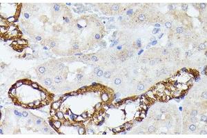 Immunohistochemistry of paraffin-embedded Rat kidney using LTF Polyclonal Antibody at dilution of 1:100 (40x lens). (Lactoferrin 抗体)