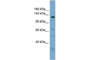 Human ACHN; WB Suggested Anti-TMEM16C Antibody Titration: 0. (ANO3 抗体  (Middle Region))