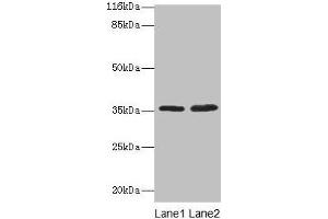 Western blot All lanes: ACKR1 antibody at 2 μg/mL Lane 1: Mouse kidney tissue Lane 2: Mouse spleen tissue Secondary Goat polyclonal to rabbit IgG at 1/10000 dilution Predicted band size: 36 kDa Observed band size: 36 kDa (DARC 抗体  (AA 1-63))