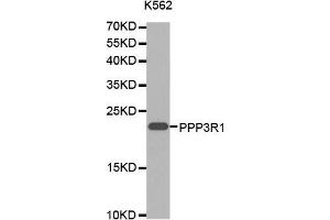 Western blot analysis of extracts of K-562 cells lines, using PPP3R1 antibody. (PPP3R1 抗体  (AA 11-170))