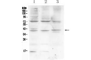 Western blot analysis of HFE using anti-HFE antibody . (HFE 抗体  (AA 82-199))