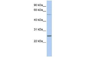 WB Suggested Anti-SCN1B Antibody Titration:  0. (SCN1B 抗体  (Middle Region))