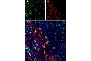 Expression of Ferroportin in mouse brain - Immunohistochemical staining of perfusion-fixed frozen mouse substantia nigra pars compacta (SNC) sections using Anti-Ferroportin (SLC40A1) Antibody (ABIN7043729, ABIN7044546 and ABIN7044547). (SLC40A1 抗体  (2nd Cytoplasmic Loop))