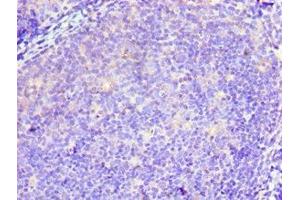 Immunohistochemistry of paraffin-embedded human tonsil tissue using ABIN7173940 at dilution of 1:100 (TWF2 抗体  (AA 1-349))