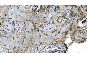 IHC analysis of Carbonic Anhydrase I/CA1 using anti-Carbonic Anhydrase I/CA1 antibody (ABIN7602621).