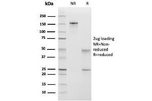 SDS-PAGE Analysis Purified Calponin-1 Mouse MAb (CNN1/832 + CALP). (CNN1 抗体)