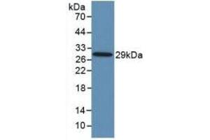 Detection of Recombinant TLR8, Human using Monoclonal Antibody to Toll Like Receptor 8 (TLR8) (TLR8 抗体  (AA 844-1039))