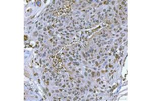 IHC analysis of SART3 using anti-SART3 antibody (ABIN7600151).