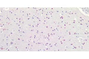 Immunohistochemistry of paraffin-embedded Human Brain using RBFOX3 Polyclonal Antibody at dilution of 1:100. (NeuN 抗体)