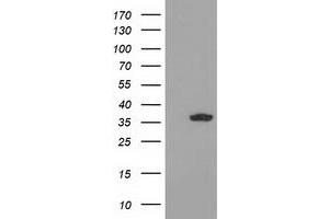 Western Blotting (WB) image for anti-Glyoxylate Reductase/hydroxypyruvate Reductase (GRHPR) antibody (ABIN1498520) (GRHPR 抗体)