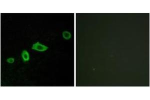 Immunofluorescence analysis of LOVO cells, using HTR5A Antibody. (Serotonin Receptor 5A 抗体  (AA 15-64))