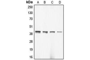 Western blot analysis of Alpha-actin-3 expression in DLD (A), HeLa (B), mouse brain (C), rat brain (D) whole cell lysates. (ACTG2 抗体  (N-Term))