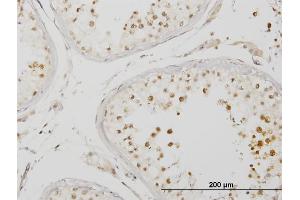 Immunoperoxidase of monoclonal antibody to IRAK4 on formalin-fixed paraffin-embedded human testis. (IRAK4 抗体  (AA 1-130))