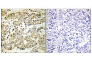 Immunohistochemistry (IHC) image for anti-14-3-3 zeta (YWHAZ) (pSer58) antibody (ABIN1847200) (14-3-3 zeta 抗体  (pSer58))