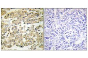 Immunohistochemistry (IHC) image for anti-14-3-3 zeta (YWHAZ) (pSer58) antibody (ABIN1847201) (14-3-3 zeta 抗体  (pSer58))