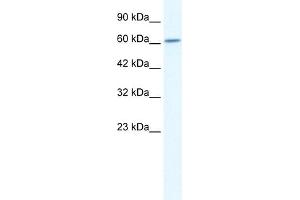 WB Suggested Anti-CUL5 Antibody Titration:  2. (Cullin 5 抗体  (C-Term))